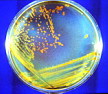 Bacteria indestructible